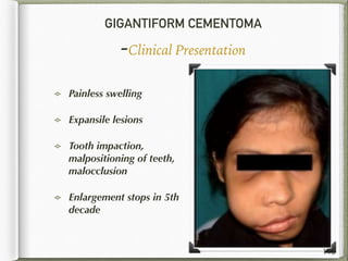 GIGANTIFORM CEMENTOMA
-Clinical Presentation
Painless swelling
Expansile lesions
Tooth impaction,
malpositioning of teeth,
malocclusion
Enlargement stops in 5th
decade
112
 