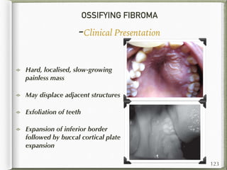 OSSIFYING FIBROMA
-Clinical Presentation
Hard, localised, slow-growing
painless mass
May displace adjacent structures
Exfoliation of teeth
Expansion of inferior border
followed by buccal cortical plate
expansion
123
 