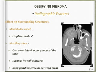 OSSIFYING FIBROMA
-Radiographic Features
Effect on Surrounding Structures-
Mandibular canal:-
Displacement- ✔
Maxillary sinus:-
Can grow into & occupy most of the
sinus
Expands its wall outwards
Bony partition remains between them 128
 