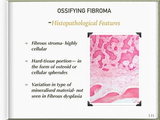 OSSIFYING FIBROMA
-Histopathological Features
Fibrous stroma- highly
cellular
Hard-tissue portion— in
the form of osteoid or
cellular spherules
Variation in type of
mineralised material- not
seen in Fibrous dysplasia
131
 