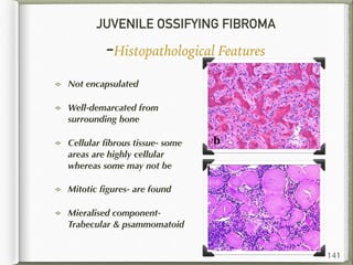 JUVENILE OSSIFYING FIBROMA
-Histopathological Features
Not encapsulated
Well-demarcated from
surrounding bone
Cellular ﬁbrous tissue- some
areas are highly cellular
whereas some may not be
Mitotic ﬁgures- are found
Mieralised component-
Trabecular & psammomatoid
141
 