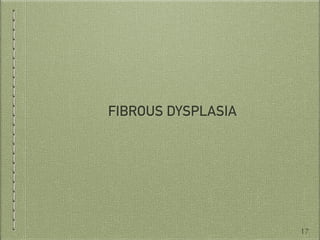 FIBROUS DYSPLASIA
17
 