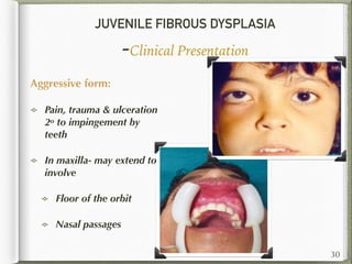 JUVENILE FIBROUS DYSPLASIA
-Clinical Presentation
Aggressive form:
Pain, trauma & ulceration
2o to impingement by
teeth
In maxilla- may extend to
involve
Floor of the orbit
Nasal passages
30
 