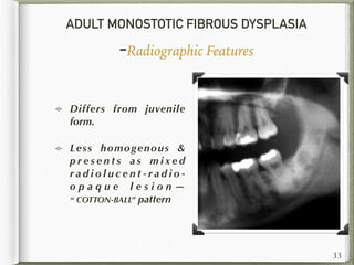 ADULT MONOSTOTIC FIBROUS DYSPLASIA
-Radiographic Features
Differs from juvenile
form.
Less homogenous &
p r e s e n t s a s m i x e d
r a d i o l u c e n t - r a d i o -
o p a q u e l e s i o n —
“ COTTON-BALL” pattern
33
 