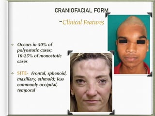CRANIOFACIAL FORM
-Clinical Features
Occurs in 50% of
polyostotic cases;
10-25% of monostotic
cases
SITE- Frontal, sphenoid,
maxillary, ethmoid; less
commonly occipital,
temporal
 