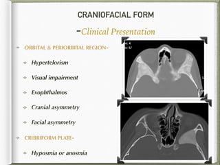 CRANIOFACIAL FORM
-Clinical Presentation
ORBITAL & PERIORBITAL REGION-
Hypertelorism
Visual impairment
Exophthalmos
Cranial asymmetry
Facial asymmetry
CRIBRIFORM PLATE-
Hyposmia or anosmia
43
 