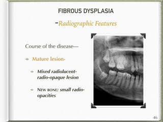 FIBROUS DYSPLASIA
-Radiographic Features
Course of the disease—
Mature lesion-
Mixed radiolucent-
radio-opaque lesion
NEW BONE: small radio-
opacities
46
 