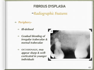 FIBROUS DYSPLASIA
-Radiographic Features
Periphery-
Ill-deﬁned
Gradual blending of
irregular trabeculae &
normal trabeculae
OCCASIONALLY, may
appear sharp & well-
corticated in younger
individuals
48
 