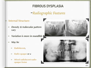 FIBROUS DYSPLASIA
-Radiographic Features
Internal Structure-
Density & trabecular pattern
vary
Variation is more in mandible
May be
Radiolucent,
Radio-opaque or a
Mixed radiolucent-radio-
opaque lesion
49
 