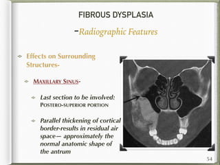 FIBROUS DYSPLASIA
-Radiographic Features
Effects on Surrounding
Structures-
MAXILLARY SINUS-
Last section to be involved:
POSTERO-SUPERIOR PORTION
Parallel thickening of cortical
border-results in residual air
space— approximately the
normal anatomic shape of
the antrum
54
 