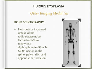 FIBROUS DYSPLASIA
-Other Imaging Modalities
BONE SCINTIGRAPHY:
Hot spots or increased
uptake of the
radioisotope tracer
technetium-99m
methylene
diphosphonate (99m Tc
MDP) occurs in the
spine, pelvis, ribs, and
appendicular skeleton.
 