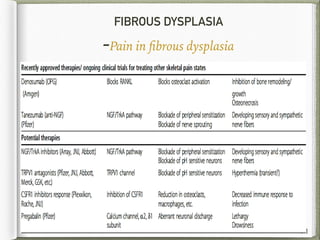 FIBROUS DYSPLASIA
-Pain in ﬁbrous dysplasia
71
 