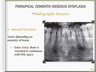 PERIAPICAL CEMENTO-OSSEOUS DYSPLASIA
-Radiographic Features
Internal Structure-
Varies depending on
maturity of lesion
EARLY STAGE: Bone is
resorbed & continuous
with PDL space
78
 