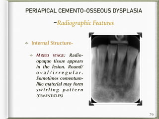 PERIAPICAL CEMENTO-OSSEOUS DYSPLASIA
-Radiographic Features
Internal Structure-
MIXED STAGE: Radio-
opaque tissue appears
in the lesion. Round/
o v a l / i r r e g u l a r .
Sometimes cementum-
like material may form
s w i r l i n g p a t t e r n
(CEMENTICLES)
79
 