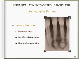 PERIAPICAL CEMENTO-OSSEOUS DYSPLASIA
-Radiographic Features
Internal Structure-
MATURE STAGE:
Totally radio-opaque.
Thin radiolucent rim
80
 