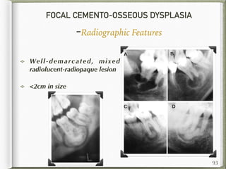 FOCAL CEMENTO-OSSEOUS DYSPLASIA
-Radiographic Features
Well-demarcated, mixed
radiolucent-radiopaque lesion
<2cm in size
93
 