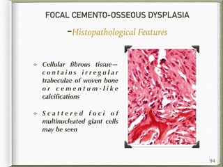 FOCAL CEMENTO-OSSEOUS DYSPLASIA
-Histopathological Features
Cellular ﬁbrous tissue—
c o n t a i n s i r r e g u l a r
trabeculae of woven bone
o r c e m e n t u m - l i k e
calciﬁcations
S c a t t e r e d f o c i o f
multinucleated giant cells
may be seen
94
 