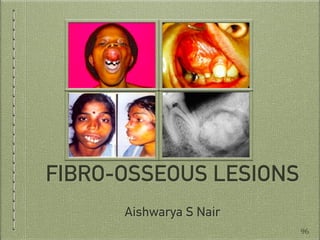 FIBRO-OSSEOUS LESIONS
Aishwarya S Nair
96
 