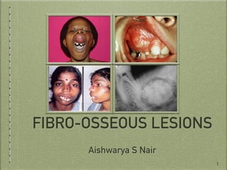 FIBRO-OSSEOUS LESIONS
Aishwarya S Nair
1
 
