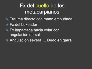 Fx del cuello de los
metacarpianos
 Trauma directo con mano empuñada
 Fx del boxeador
 Fx impactada hacia volar con
angulación dorsal
 Angulación severa…. Dedo en garra
 