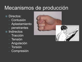 Mecanismos de producción
 Directos:
- Contusión
- Aplastamiento
- penetrantes
 Indirectos
- Tracción
- Tensión
- Angulación
- Torsión
- Compresión
 