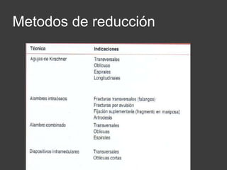 Metodos de reducción
 