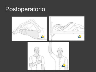 Postoperatorio
 