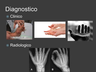 Diagnostico
 Clinico
 Radiologico
 