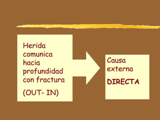 Herida
comunica
hacia
profundidad
con fractura
(OUT- IN)
Causa
externa
DIRECTA
 