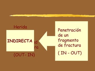 Herida
comunica
hacia
profundidad
con fractura
(OUT- IN)
INDIRECTA
Penetración
de un
fragmento
de fractura
( IN - OUT)
 