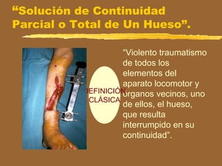 “Solución de Continuidad
Parcial o Total de Un Hueso”.
“Violento traumatismo
de todos los
elementos del
aparato locomotor y
órganos vecinos, uno
de ellos, el hueso,
que resulta
interrumpido en su
continuidad”.
DEFINICIÓN
CLÁSICA
 