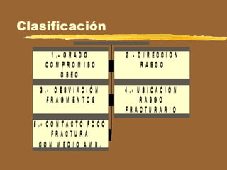 Clasificación
 