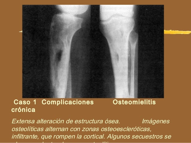 El ejercicio para el aumento de la potencia