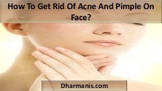 How To Get Rid Of Acne And Pimple On
Face?
Dharmanis.com
 