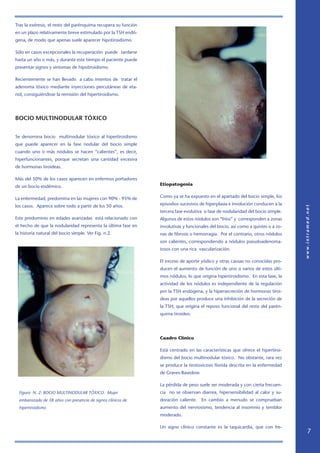 Tras la exéresis, el resto del parénquima recupera su función
en un plazo relativamente breve estimulado por la TSH endó-
gena, de modo que apenas suele aparecer hipotiroidismo.
Sólo en casos excepcionales la recuperación puede tardarse
hasta un año o más, y durante este tiempo el paciente puede
presentar signos y síntomas de hipotiroidismo.
Recientemente se han llevado a cabo intentos de tratar el
adenoma tóxico mediante inyecciones percutáneas de eta-
nol, consiguiéndose la remisión del hipertiroidismo.
BOCIO MULTINODULAR TÓXICO
Se denomina bocio multinodular tóxico al hipertiroidismo
que puede aparecer en la fase nodular del bocio simple
cuando uno o más nódulos se hacen “calientes”, es decir,
hiperfuncionantes, porque secretan una cantidad excesiva
de hormonas tiroideas.
Más del 50% de los casos aparecen en enfermos portadores
de un bocio endémico.
La enfermedad, predomina en las mujeres con 90% - 95% de
los casos. Aparece sobre todo a partir de los 50 años.
Este predominio en edades avanzadas está relacionado con
el hecho de que la nodularidad representa la última fase en
la historia natural del bocio simple. Ver Fig. n.2.
Figura N. 2: BOCIO MULTINODULAR TÓXICO. Mujer
embarazada de 38 años con presencia de signos clínicos de
hipertiroidismo
Etiopatogenia
Como ya se ha expuesto en el apartado del bocio simple, los
episodios sucesivos de hiperplasia e involución conducen a la
tercera fase evolutiva o fase de nodularidad del bocio simple.
Algunos de estos nódulos son “fríos” y corresponden a zonas
involutivas y funcionales del bocio, así como a quistes o a zo-
nas de fibrosis o hemorragia. Por el contrario, otros nódulos
son calientes, correspondiendo a nódulos pseudoadenoma-
tosos con una rica vascularización.
El exceso de aporte yódico y otras causas no conocidas pro-
ducen el aumento de función de uno o varios de estos últi-
mos nódulos, lo que origina hipertiroidismo. En esta fase, la
actividad de los nódulos es independiente de la regulación
por la TSH endógena, y la hipersecreción de hormonas tiroi-
deas por aquellos produce una inhibición de la secreción de
la TSH, que origina el reposo funcional del resto del parén-
quima tiroideo.
Cuadro Clínico
Está centrado en las características que ofrece el hipertiroi-
dismo del bocio multinodular tóxico. No obstante, rara vez
se produce la tirotoxicosis florida descrita en la enfermedad
de Graves-Basedow.
La pérdida de peso suele ser moderada y con cierta frecuen-
cia no se observan diarrea, hipersensibilidad al calor y su-
doración caliente. En cambio a menudo se comprueban
aumento del nerviosismo, tendencia al insomnio y temblor
moderado.
Un signo clínico constante es la taquicardia, que con fre-
 