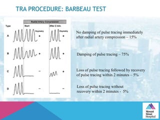 TRA PROCEDURE: BARBEAU TEST
No damping of pulse tracing immediately
after radial artery compression – 15%
Damping of pulse tracing – 75%
Loss of pulse tracing followed by recovery
of pulse tracing within 2 minutes – 5%
Loss of pulse tracing without
recovery within 2 minutes - 5%
 