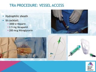 TRA PROCEDURE: VESSEL ACCESS
 Hydrophilic sheath
 IA cocktail:
 3000 U Heparin
 2.5 mg Verapamil
 200 mcg Nitroglycerin
 