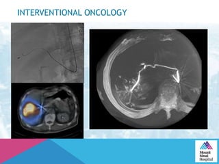 INTERVENTIONAL ONCOLOGY
 