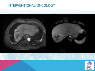 INTERVENTIONAL ONCOLOGY
 