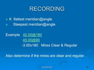 RECORDING


K flattest meridian@angle

Steepest meridian@angle
Example 42.00@180
45.00@90
-3.00x180 Mires Clear & Regula...