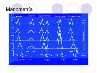 Manometría 