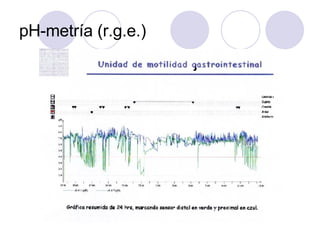 pH-metría (r.g.e.) 