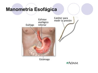 Manometría Esofágica 