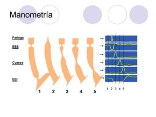 Manometría 
