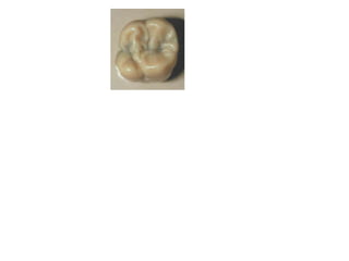 10 maxillary ( first , second , third ) molars . | PPTX