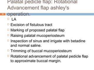 Palatal pedicle flap: Rotational
Advancement flap ashley's
operation.59
  LA
 Excision of fistulous tract
 Marking of proposed palatal flap
 Raising palatal mucoperiosteum
 Inspection of sinus and irrigate with betadine
and normal saline.
 Trimming of buccal mucoperiosteum
 Rotational advancement of palatal pedicle flap
to approximate buccal margin.
 