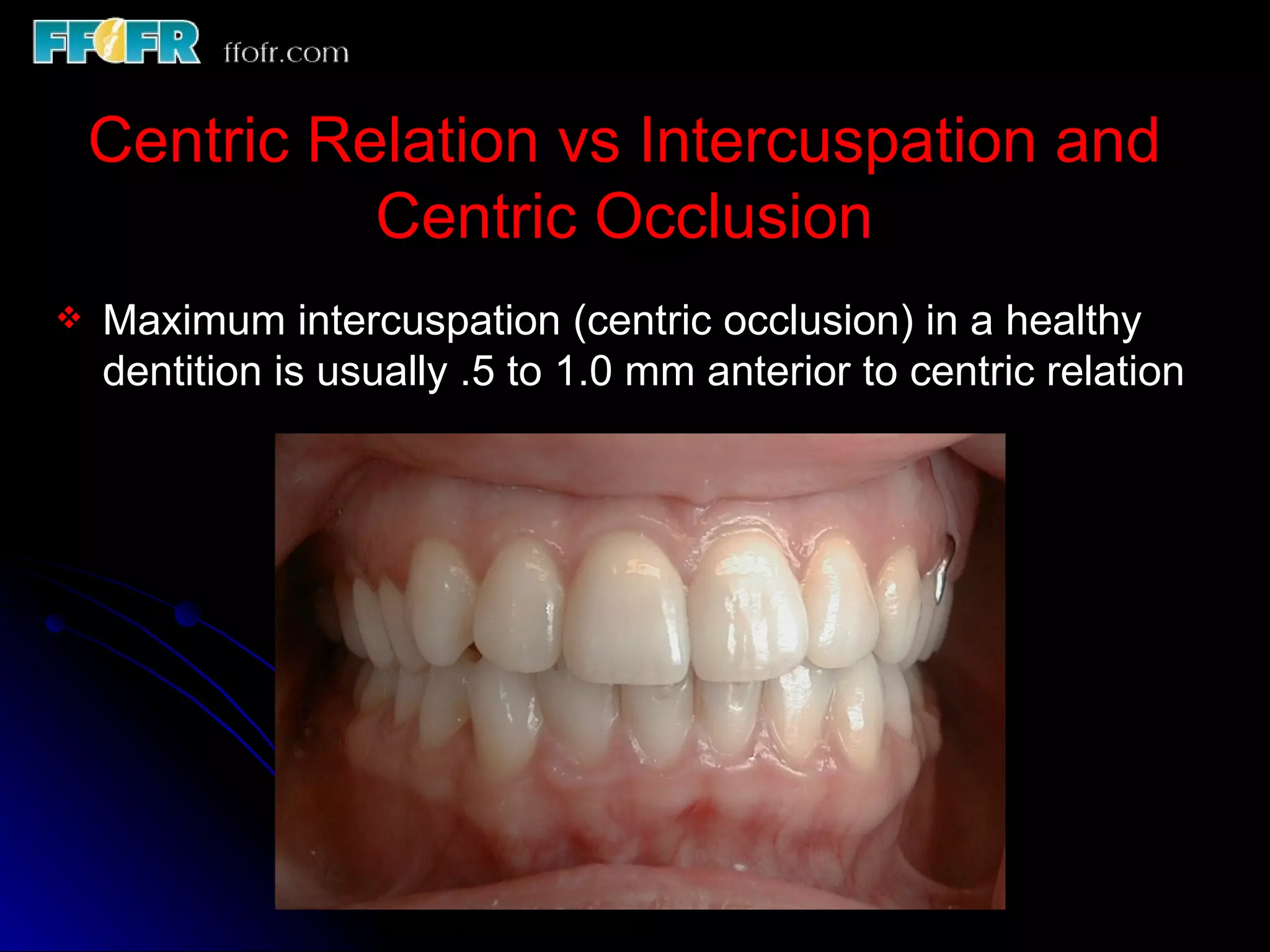 10.maxillo mandibular records | PPT