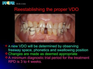 10.maxillo mandibular records | PPT