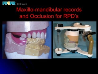 Occlusal Record Rpd 10.maxillo mandibular records | PPT