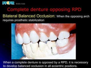 Occlusal Record Rpd 10.maxillo mandibular records | PPT